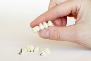 Мифы о протезировании зубов